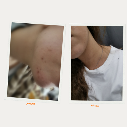 Ma peau